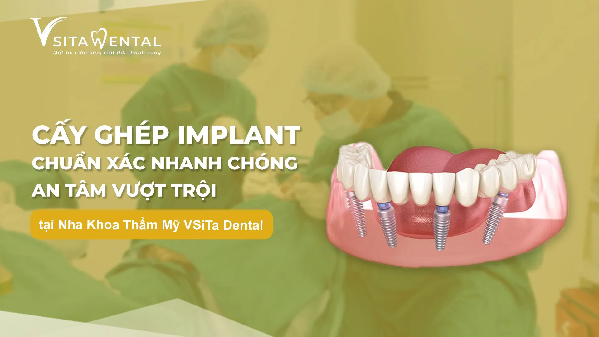 Giảm giá 5% khi thực hiện cấy ghép implant toàn hàm tại VSiTa Dental